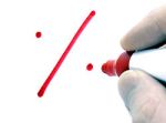 Festgeld-Termingeld-gebundene Spareinlage-Spareinlage-Einlage-Sparer-sparen-Zinsen-Verzinsung-Fixzinsen-fixe Zinsen-Bankdirekt.at-Direktbank-Raiffeisenlandesbank Ober&ouml;sterreich-RLB O&Ouml;-Fixzinskonditionen-Konditionen-Laufzeit-Geldanlage-Vergleich-